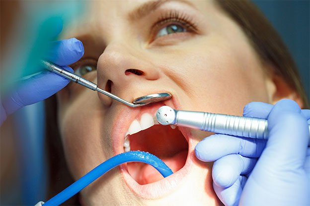 piercing dental